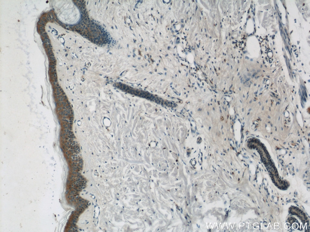 Immunohistochemistry (IHC) staining of human skin tissue using TRIM29 Polyclonal antibody (17542-1-AP)