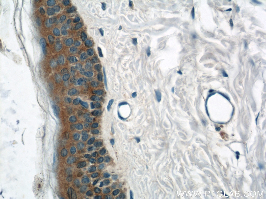 Immunohistochemistry (IHC) staining of human skin tissue using TRIM29 Polyclonal antibody (17542-1-AP)