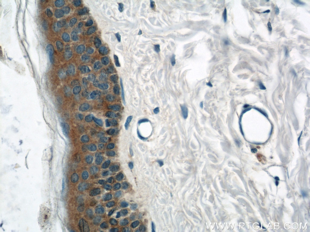 IHC staining of human skin using 17542-1-AP