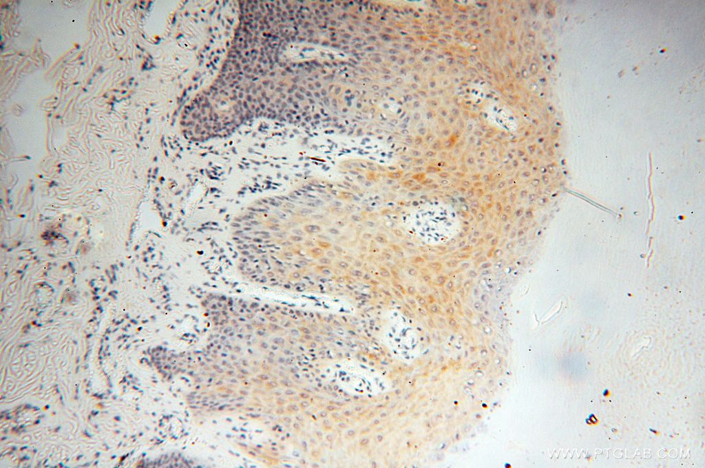 Immunohistochemistry (IHC) staining of human skin tissue using TRIM29 Polyclonal antibody (17542-1-AP)