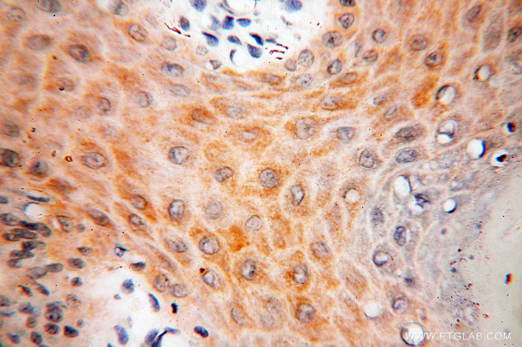 IHC staining of human skin using 17542-1-AP