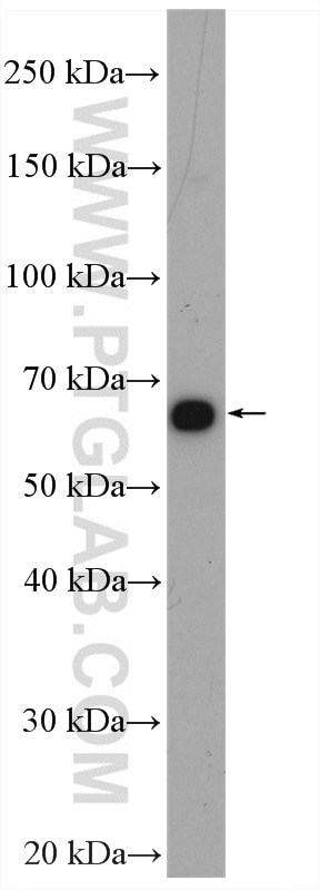 Western Blot (WB) analysis of BGC-823 cells using TRIM29 Polyclonal antibody (17542-1-AP)