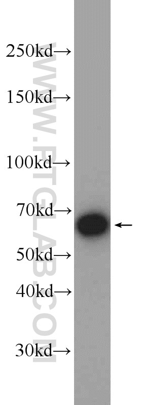 Western Blot (WB) analysis of A431 cells using TRIM29 Polyclonal antibody (17542-1-AP)