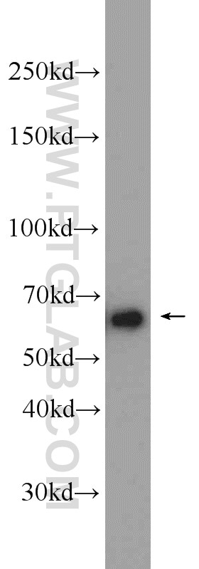 Western Blot (WB) analysis of A431 cells using TRIM29 Polyclonal antibody (17542-1-AP)