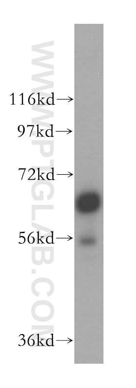Western Blot (WB) analysis of HeLa cells using TRIM29 Polyclonal antibody (17542-1-AP)