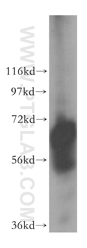 Western Blot (WB) analysis of A431 cells using TRIM29 Polyclonal antibody (17542-1-AP)