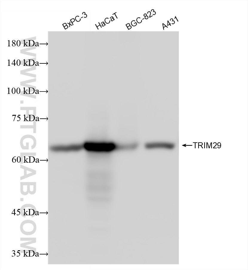 Western Blot (WB) analysis of various lysates using TRIM29 Recombinant antibody (86496-1-RR)