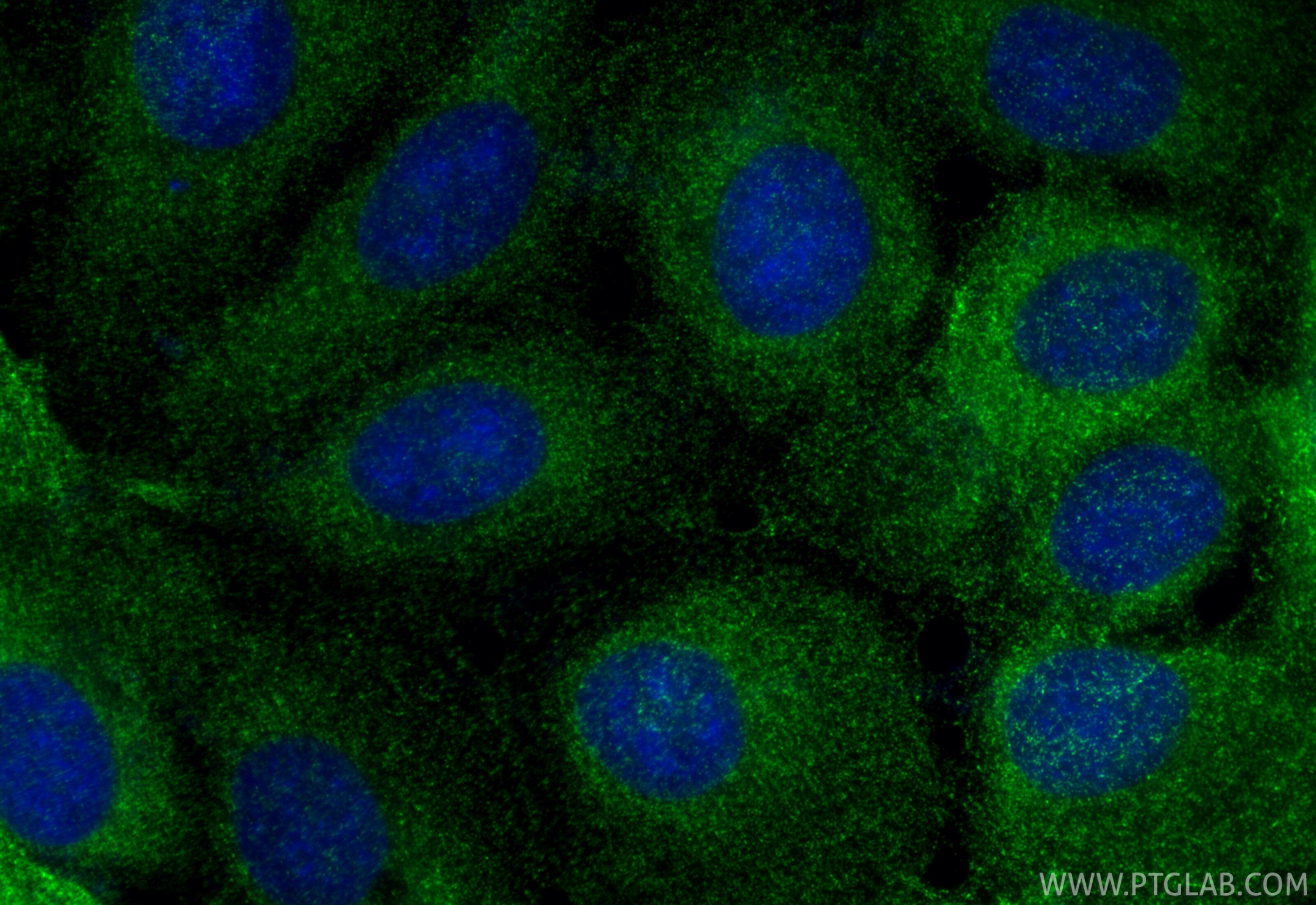 Immunofluorescence (IF) / fluorescent staining of A431 cells using Multi-rAb® TRIM29 Multi-Recombinant antibody (RMX00086)