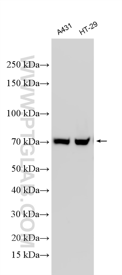 Western Blot (WB) analysis of various lysates using Multi-rAb® TRIM29 Multi-Recombinant antibody (RMX00086)