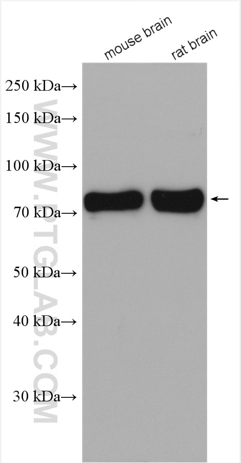 Western Blot (WB) analysis of various lysates using TRIM3 Polyclonal antibody (28392-1-AP)