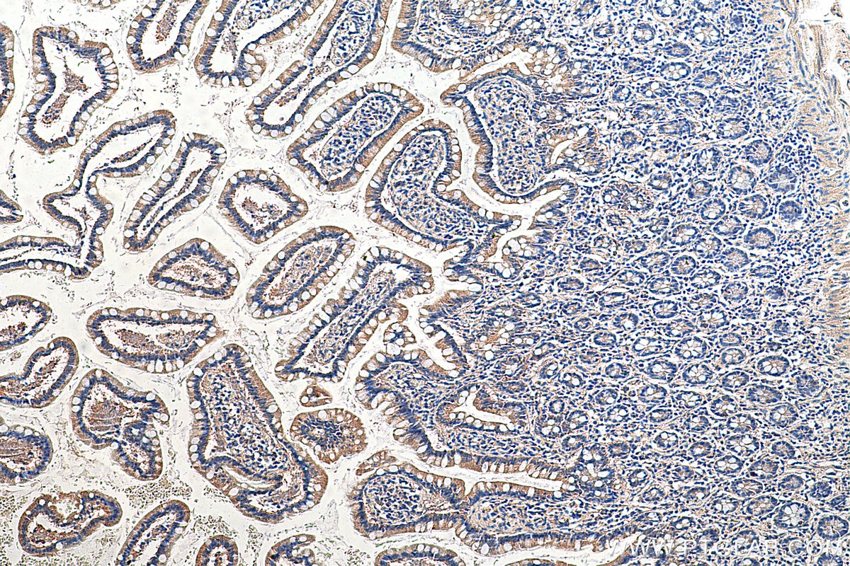 Immunohistochemistry (IHC) staining of human small intestine tissue using TRIM31 Polyclonal antibody (12543-1-AP)