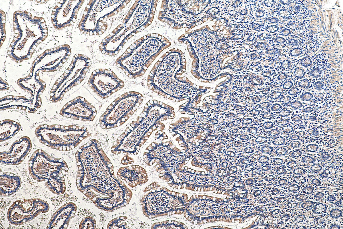 IHC staining of human small intestine using 12543-1-AP