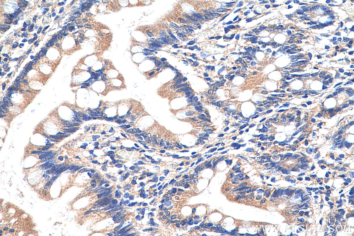 Immunohistochemistry (IHC) staining of human small intestine tissue using TRIM31 Polyclonal antibody (12543-1-AP)