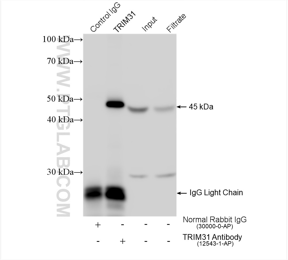Immunoprecipitation (IP) experiment of HT-29 cells using TRIM31 Polyclonal antibody (12543-1-AP)
