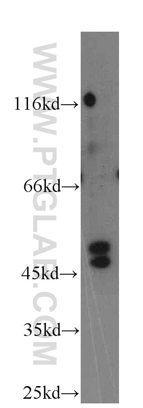 Western Blot (WB) analysis of COLO 320 cells using TRIM31 Polyclonal antibody (12543-1-AP)