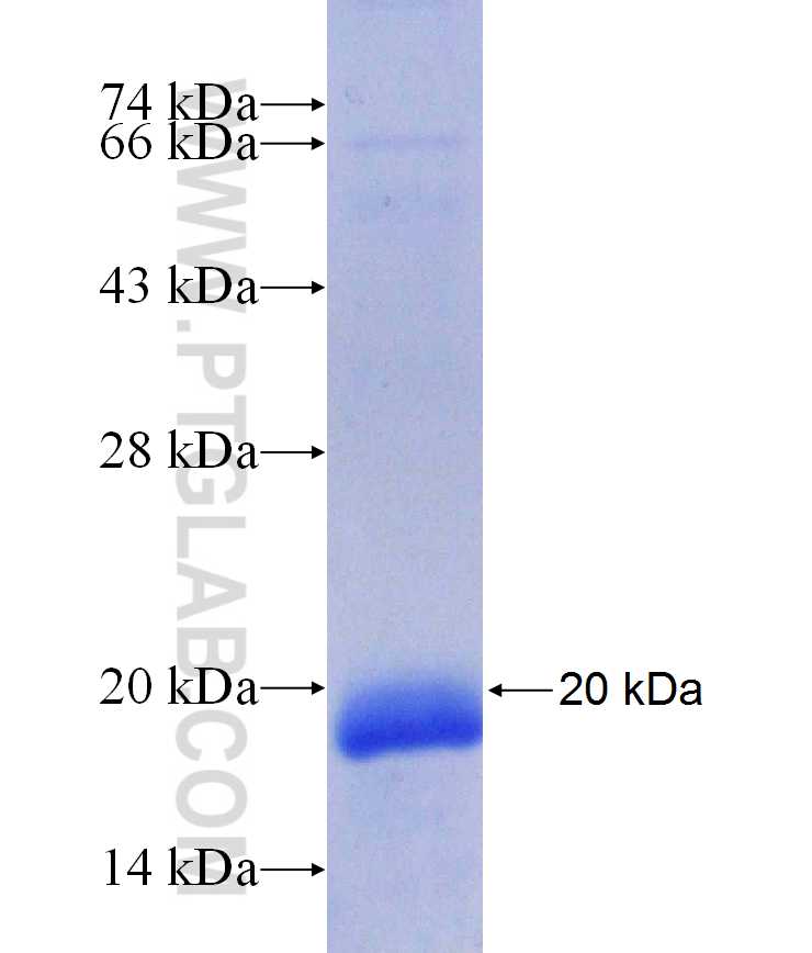 TRIM31 fusion protein Ag29697 SDS-PAGE