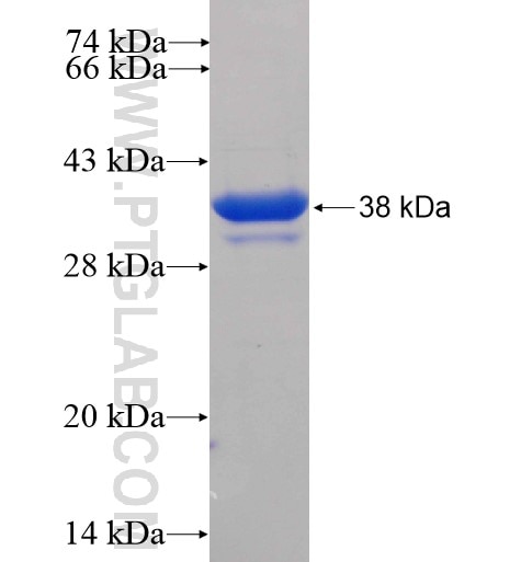 TRIM31 fusion protein Ag3264 SDS-PAGE