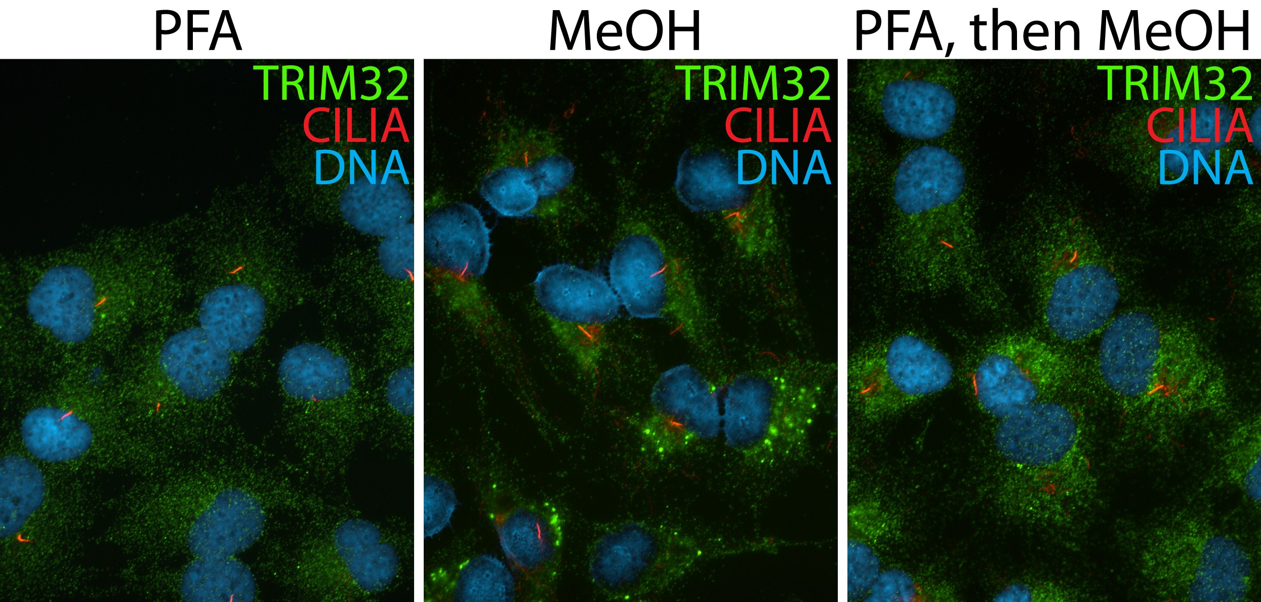 Immunofluorescence (IF) / fluorescent staining of hTERT-RPE1 cells using TRIM32 Polyclonal antibody (10326-1-AP)