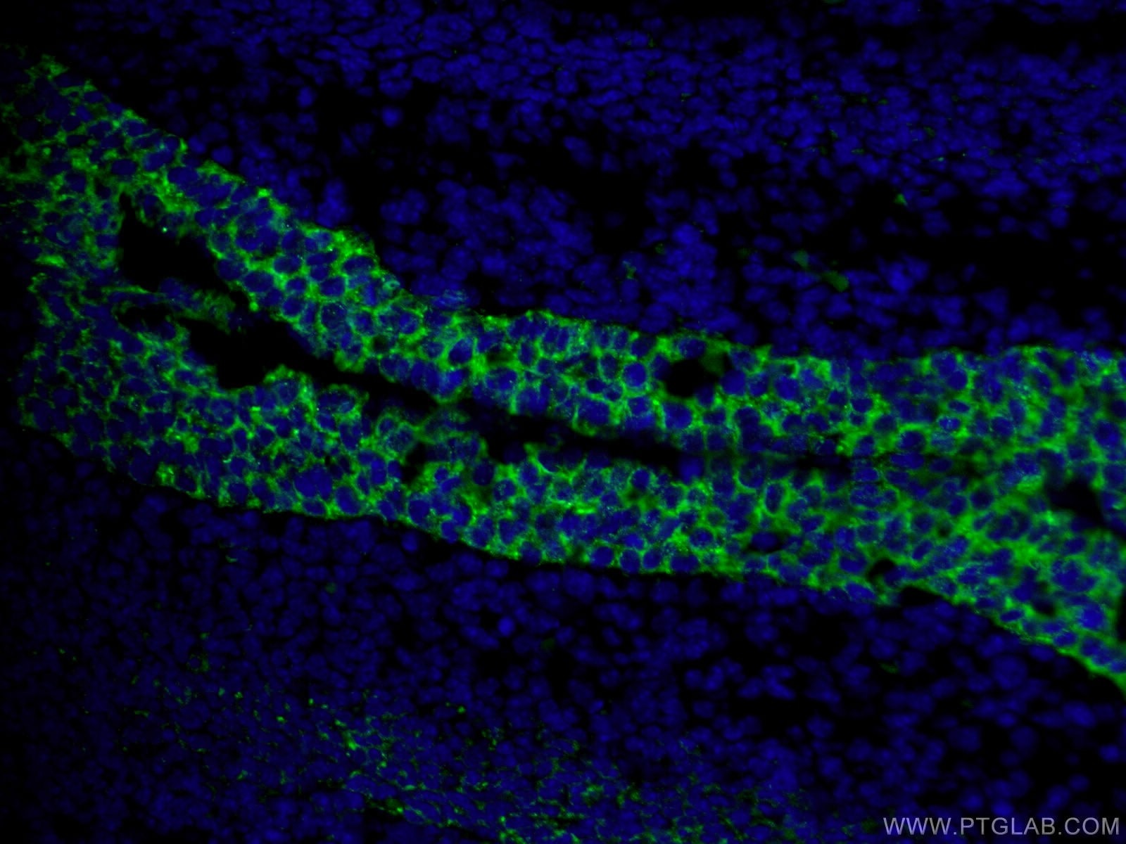 Immunofluorescence (IF) / fluorescent staining of mouse embryo tissue using TRIM32 Polyclonal antibody (10326-1-AP)