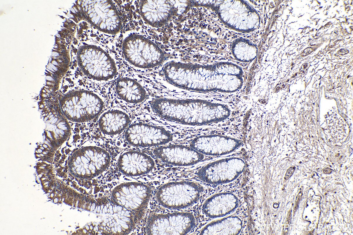 Immunohistochemistry (IHC) staining of human colon tissue using TRIM32 Polyclonal antibody (10326-1-AP)