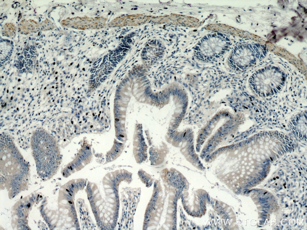 Immunohistochemistry (IHC) staining of human colon tissue using TRIM32 Polyclonal antibody (10326-1-AP)
