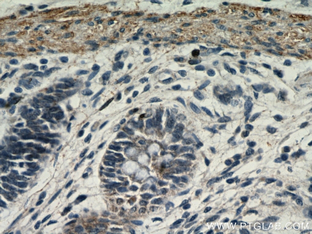 Immunohistochemistry (IHC) staining of human colon tissue using TRIM32 Polyclonal antibody (10326-1-AP)