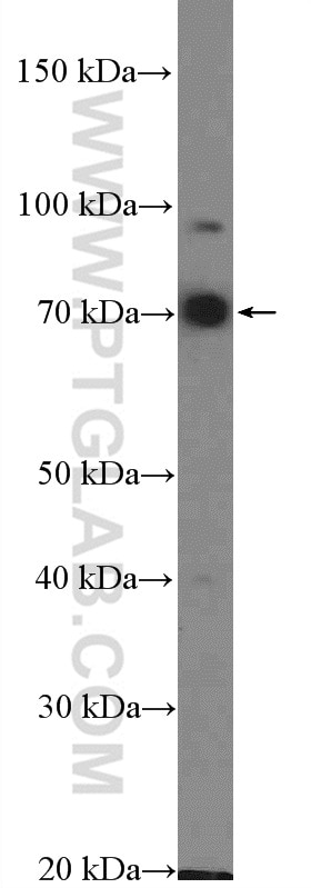 Western Blot (WB) analysis of HEK-293 cells using TRIM32 Polyclonal antibody (10326-1-AP)