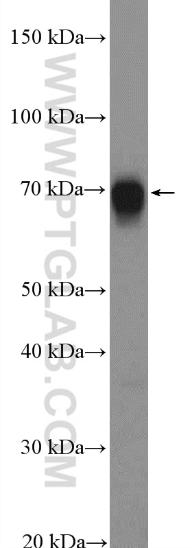 Western Blot (WB) analysis of mouse colon tissue using TRIM32 Polyclonal antibody (10326-1-AP)