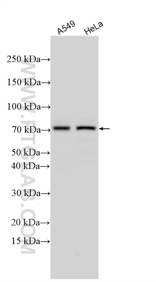 Western Blot (WB) analysis of various lysates using TRIM32 Polyclonal antibody (10326-1-AP)
