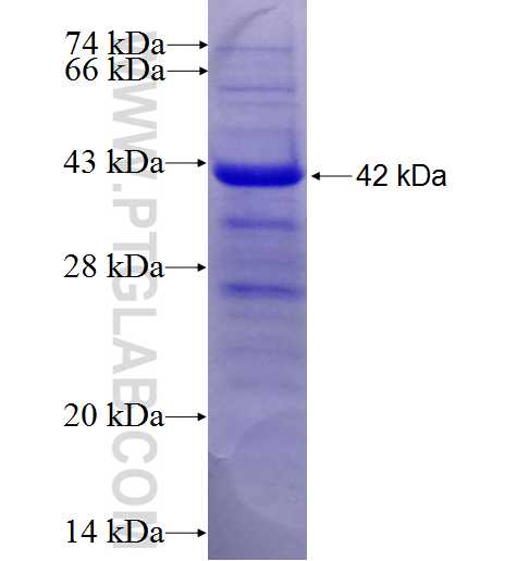 TRIM32 fusion protein Ag24346 SDS-PAGE TRIM32 fusion protein Ag24346 SDS-PAGE
