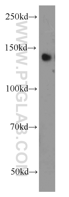 Western Blot (WB) analysis of MCF-7 cells using TRIM33 Polyclonal antibody (55374-1-AP)