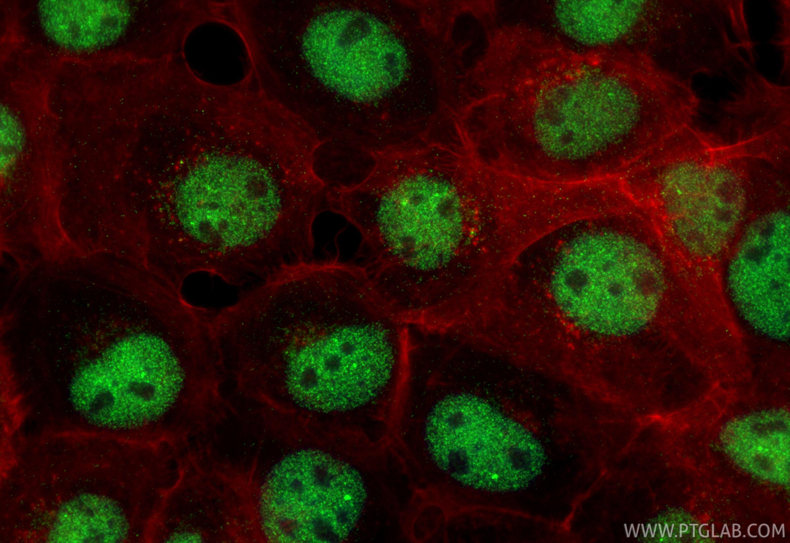Immunofluorescence (IF) / fluorescent staining of A431 cells using TRIM33 Recombinant monoclonal antibody (85364-3-RR)