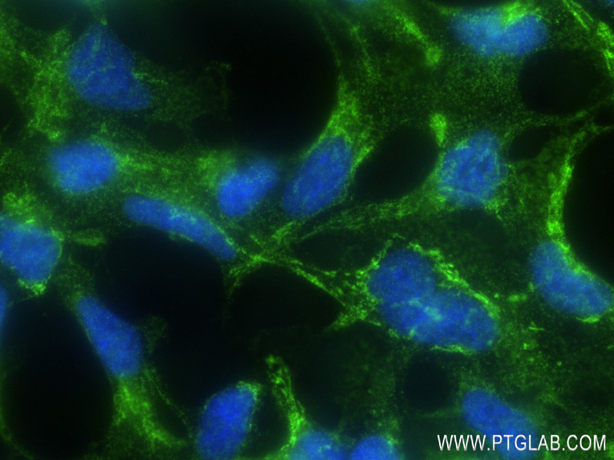 Immunofluorescence (IF) / fluorescent staining of HEK-293 cells using TRIM34 Recombinant antibody (83316-2-RR)