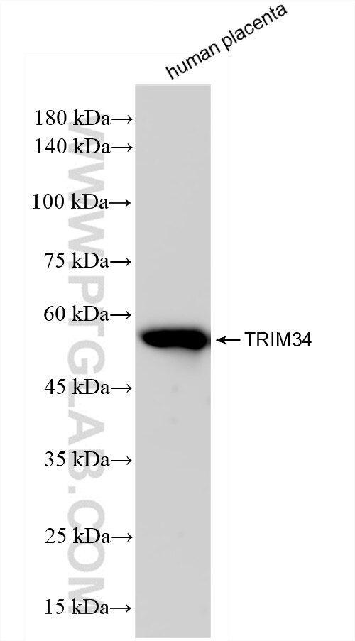 Western Blot (WB) analysis of human placenta tissue using TRIM34 Recombinant antibody (83316-2-RR)