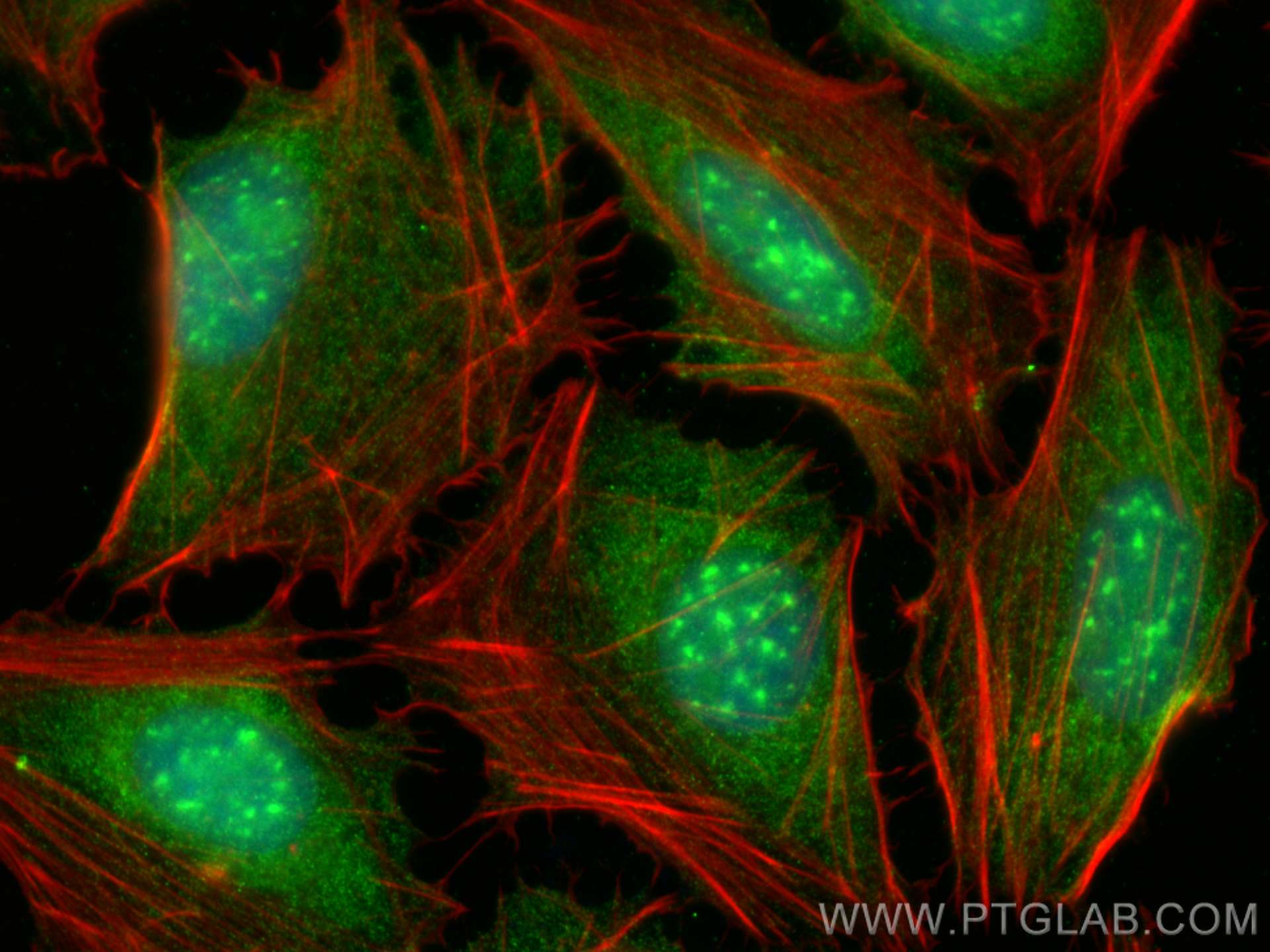 Immunofluorescence (IF) / fluorescent staining of U2OS cells using TRIM35 Polyclonal antibody (19806-1-AP)