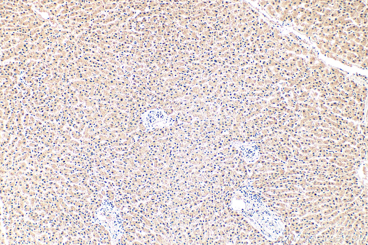 Immunohistochemistry (IHC) staining of human liver tissue using TRIM35 Polyclonal antibody (19806-1-AP)