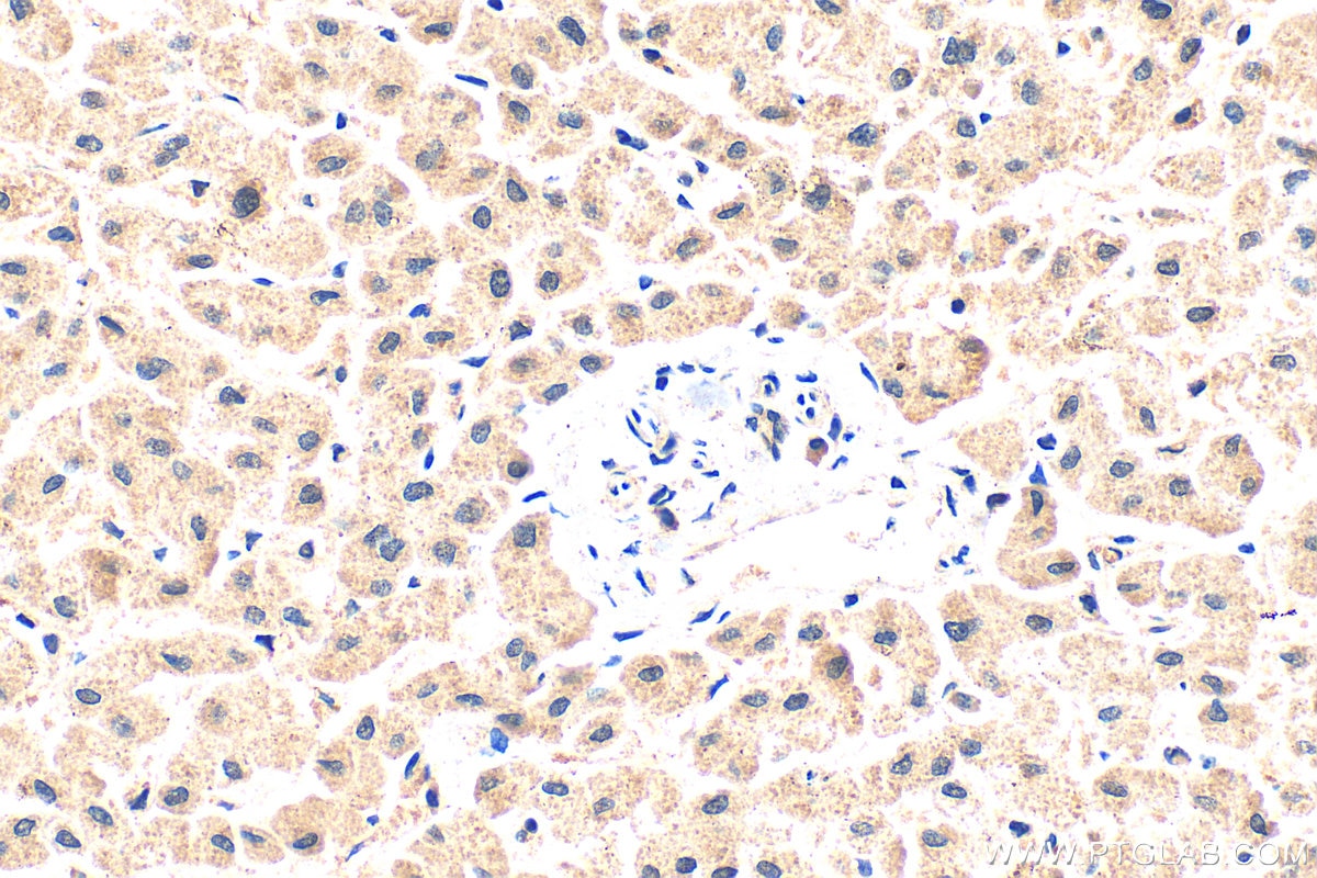 Immunohistochemistry (IHC) staining of human liver tissue using TRIM35 Polyclonal antibody (19806-1-AP)