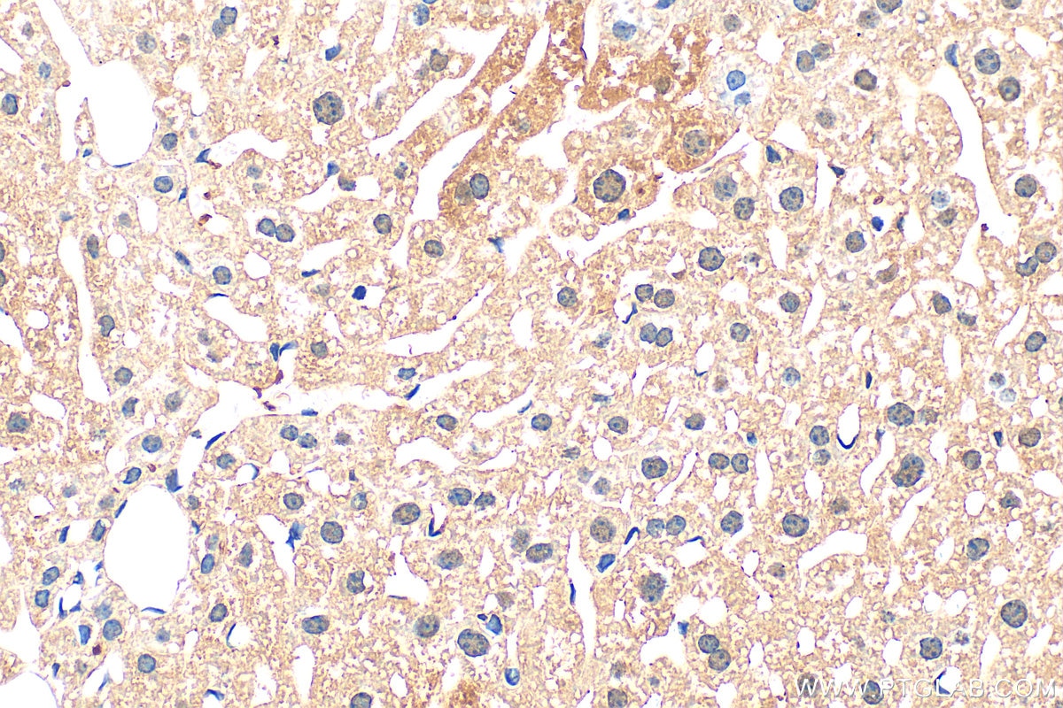 Immunohistochemistry (IHC) staining of mouse liver tissue using TRIM35 Polyclonal antibody (19806-1-AP)
