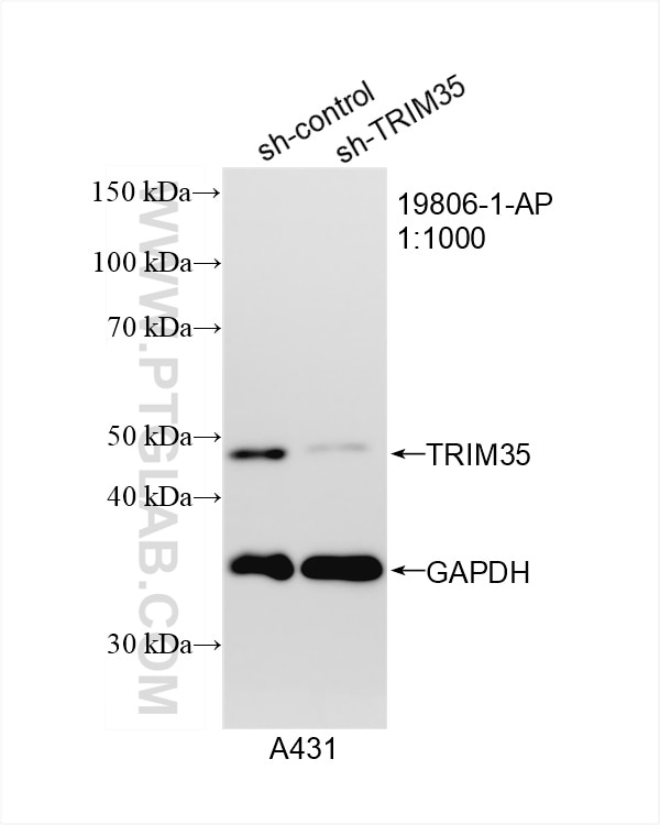 Western Blot (WB) analysis of A431 cells using TRIM35 Polyclonal antibody (19806-1-AP)