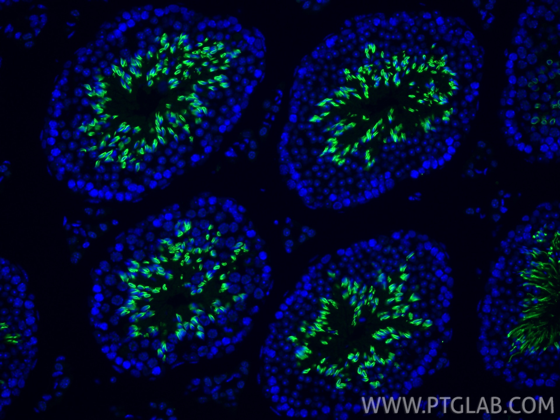 Immunofluorescence (IF) / fluorescent staining of mouse testis tissue using TRIM36 Polyclonal antibody (25913-1-AP)