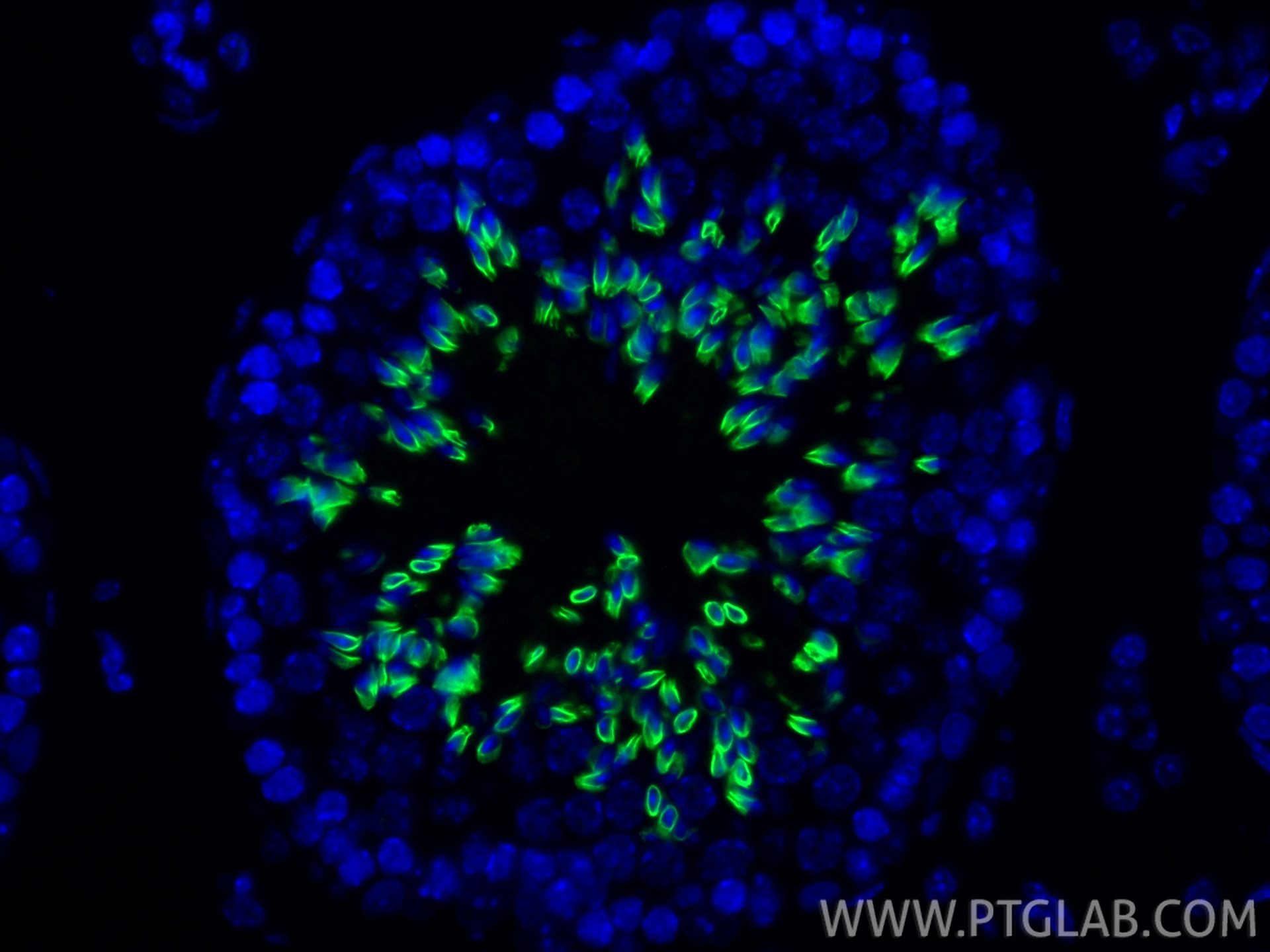Immunofluorescence (IF) / fluorescent staining of mouse testis tissue using TRIM36 Polyclonal antibody (25913-1-AP)