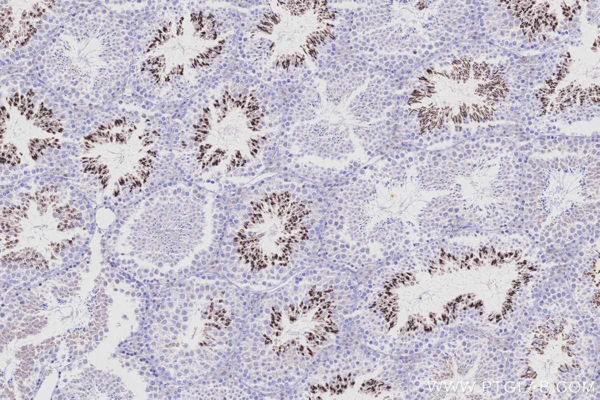 Immunohistochemistry (IHC) staining of mouse testis tissue using TRIM36 Polyclonal antibody (25913-1-AP)