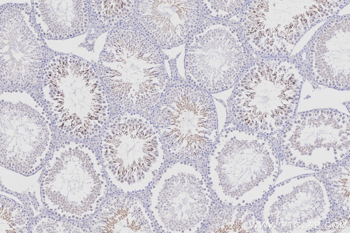 Immunohistochemistry (IHC) staining of rat testis tissue using TRIM36 Polyclonal antibody (25913-1-AP)