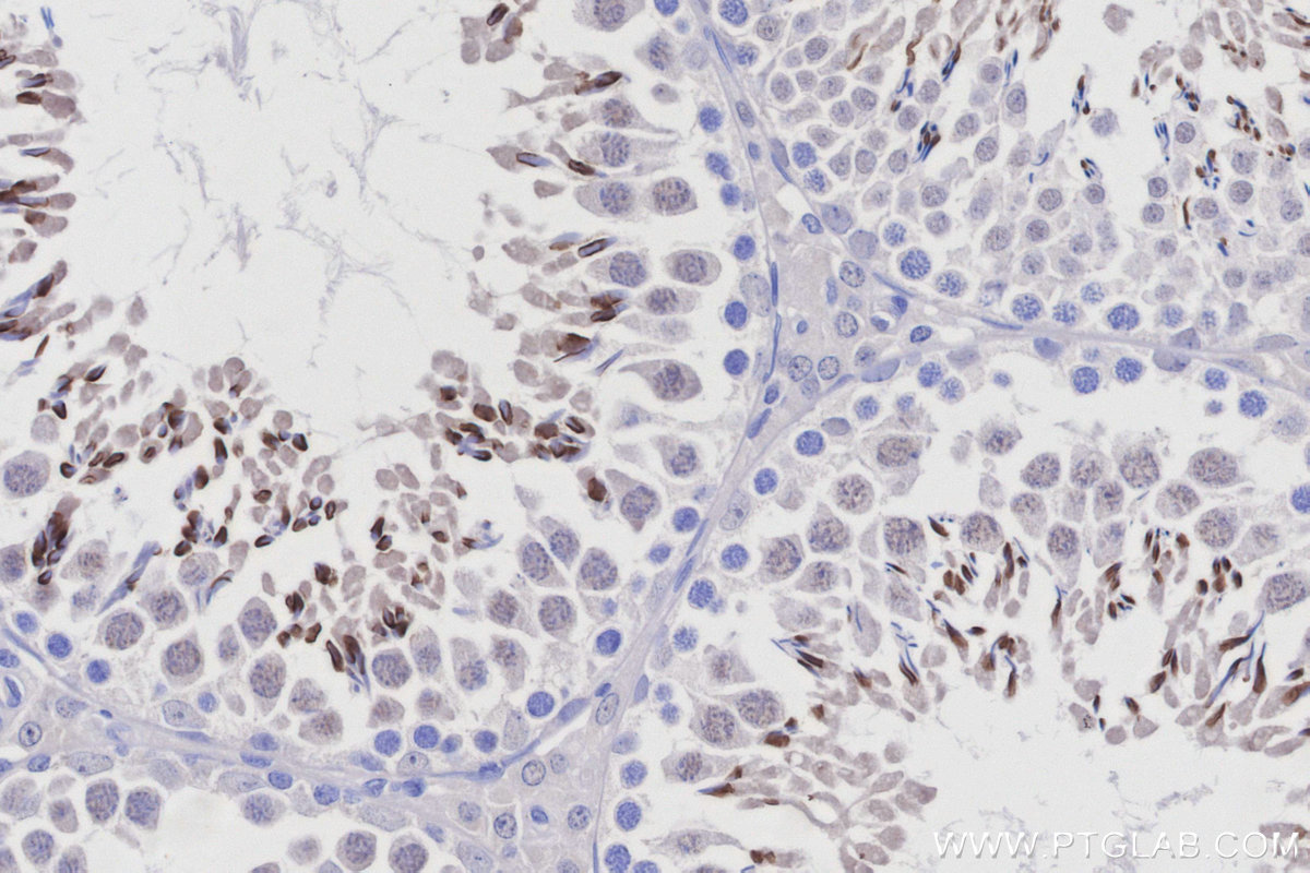 Immunohistochemistry (IHC) staining of rat testis tissue using TRIM36 Polyclonal antibody (25913-1-AP)