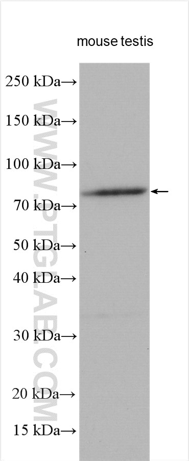 Western Blot (WB) analysis of various lysates using TRIM36 Polyclonal antibody (25913-1-AP)