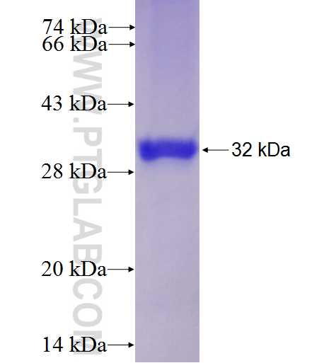 TRIM36 fusion protein Ag23240 SDS-PAGE