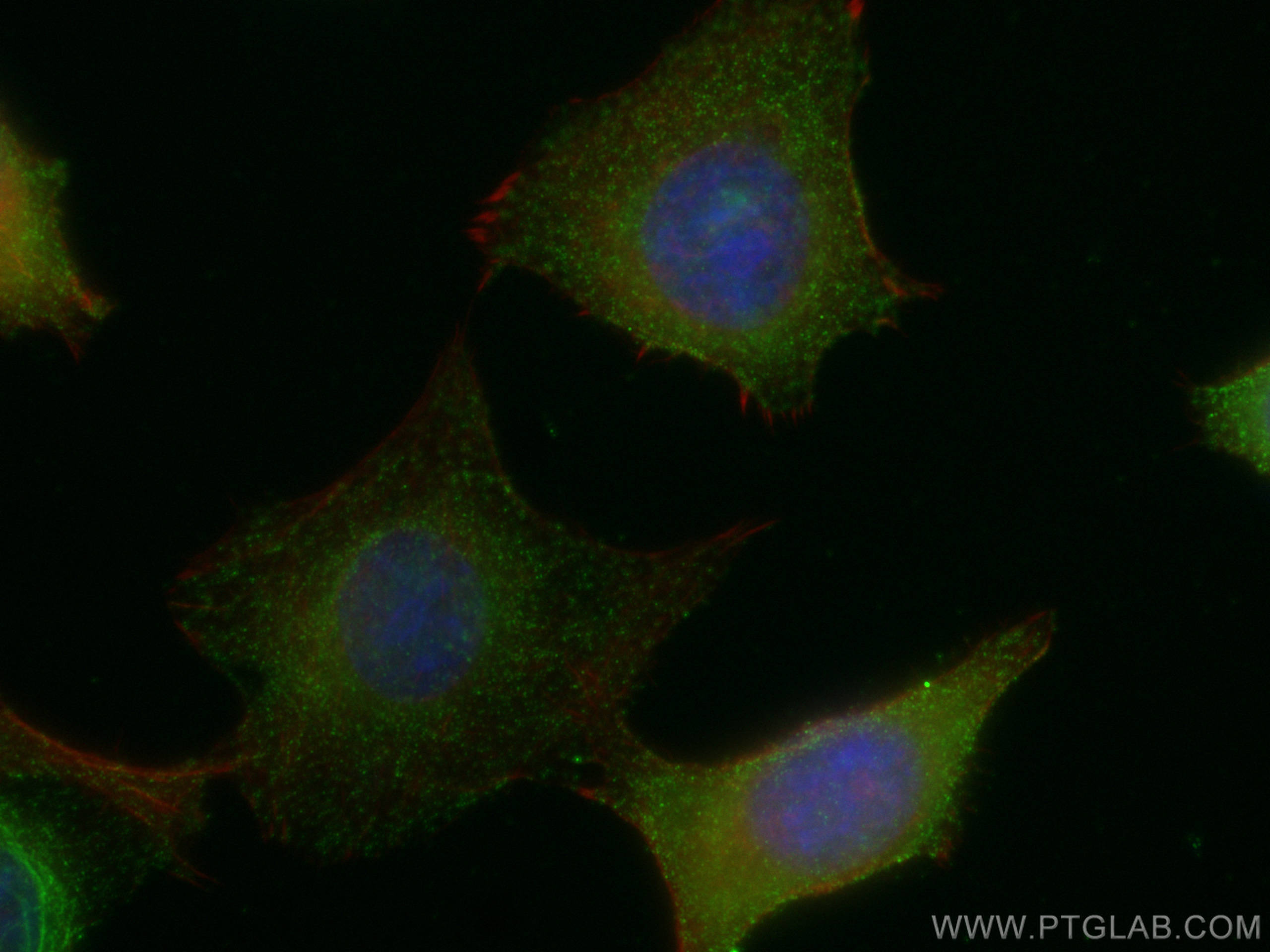 Immunofluorescence (IF) / fluorescent staining of MCF-7 cells using TRIM37 Polyclonal antibody (13037-1-AP)