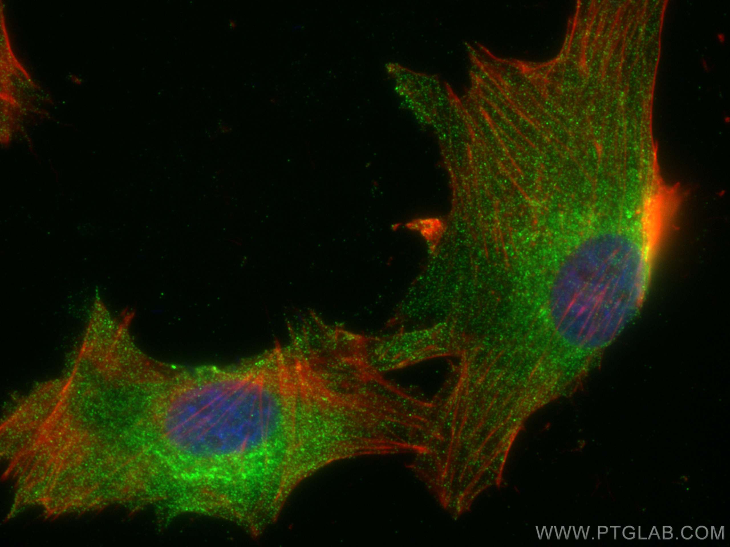 Immunofluorescence (IF) / fluorescent staining of U-87 MG cells using TRIM37 Polyclonal antibody (13037-1-AP)