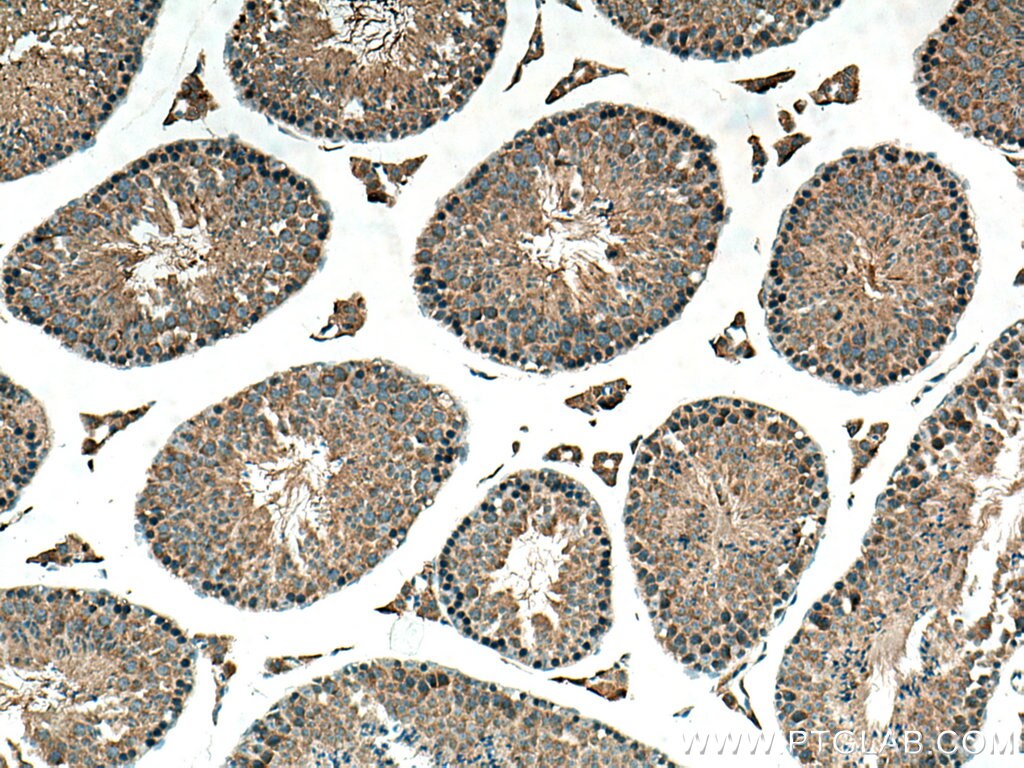 Immunohistochemistry (IHC) staining of mouse testis tissue using TRIM37 Polyclonal antibody (13037-1-AP)