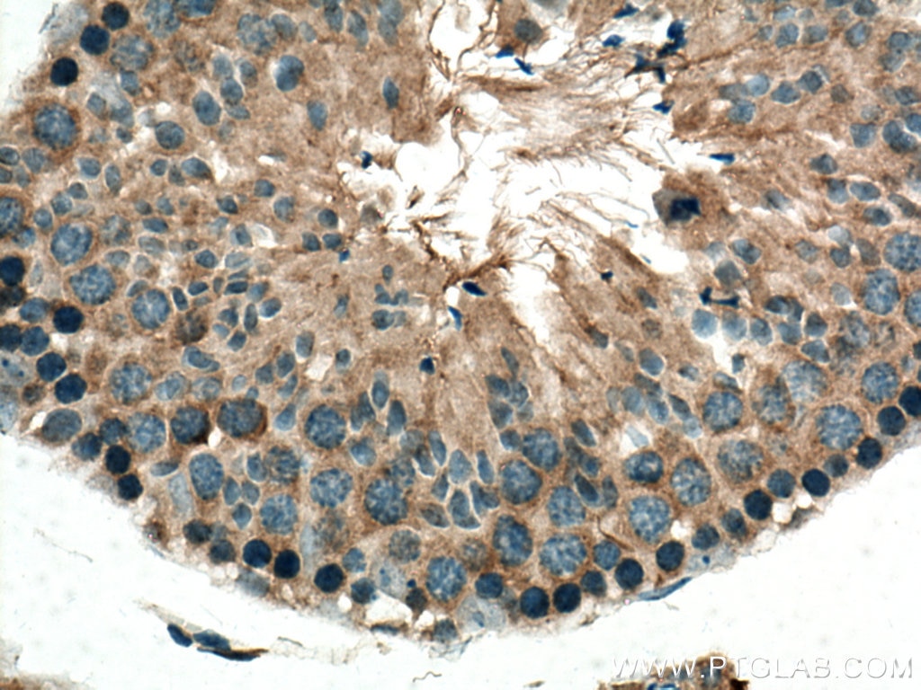 Immunohistochemistry (IHC) staining of mouse testis tissue using TRIM37 Polyclonal antibody (13037-1-AP)